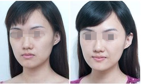 樂(lè)山眼周紋祛除醫(yī)院排名TOP10，口碑實(shí)錄揭秘！