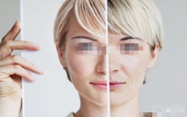 西安靜線紋整形醫(yī)院口碑榜單，助你找回青春容貌