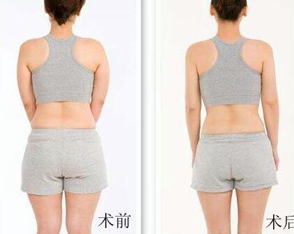 最新出爐！10大太原祛抬頭紋整形機構(gòu)推薦指南