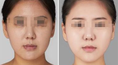 鄭州激光點陣祛黑痣醫(yī)美機構(gòu)名錄：10家精選推薦