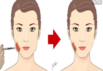 洛陽祛眼角細紋十大口碑醫(yī)院排名公布！