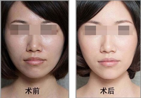 夏日必備美腿攻略：讓你的雙腿更加修長自信！