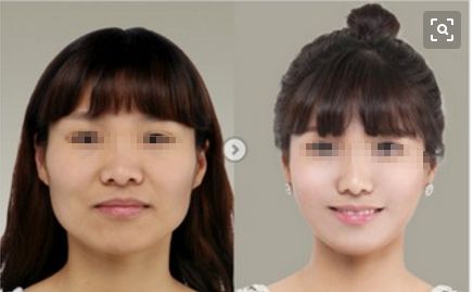 金華重瞼術(shù)醫(yī)院排行榜揭曉！前十強(qiáng)震撼上榜，你知道嗎？