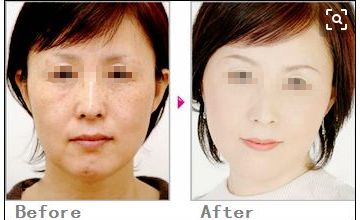 沈陽眼底紋微整形醫(yī)院排名前10，你需要知道的眼部美容信息