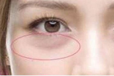 冰點(diǎn)脫毛效果實(shí)拍對(duì)比，輕松判斷是否值得嘗試