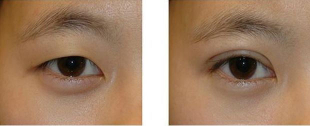 盤點(diǎn)口碑比較好的樂山水光針祛眼底紋醫(yī)院前十名