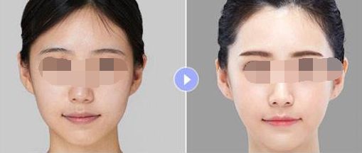 廣深整形醫(yī)院實(shí)力大PK：十強(qiáng)榜單大測(cè)評(píng)！