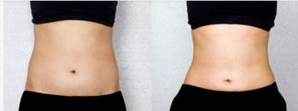 湖州專業(yè)美眼術醫(yī)院排名TOP10