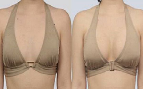 張家港哪家醫(yī)院能有效消除額頭皺紋？前十醫(yī)院排名大揭秘！