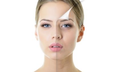 解密美白神器：激光美白祛曬黑效果大解析