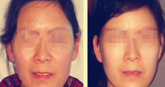 泰州修復(fù)鼻子醫(yī)院口碑排名揭秘，十大全新陣容揭曉！