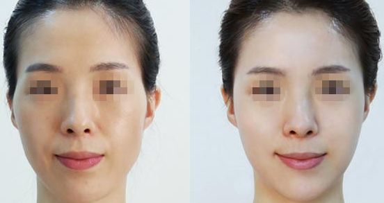 不同發(fā)質(zhì)者的專業(yè)洗發(fā)技巧，脫發(fā)問題終結(jié)攻略