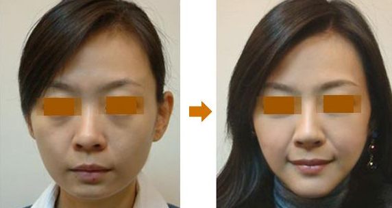 重慶豐臀術(shù)整形醫(yī)院實力大盤點：前10家推薦