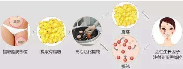 廣州膠原蛋白打臥蠶整形醫(yī)院排名揭秘！