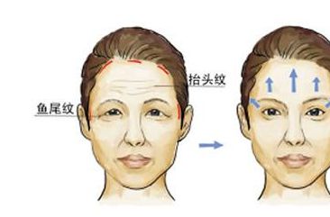 呼和浩特眼瞼去脂肪醫(yī)院排行榜：精選TOP10名單出爐！