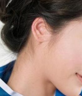 黃石治療假性眼袋吸脂排行榜TOP10！用戶好評如潮