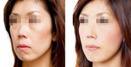 浙江省口碑卓越的太田痣祛除醫(yī)療機(jī)構(gòu)大盤(pán)點(diǎn)