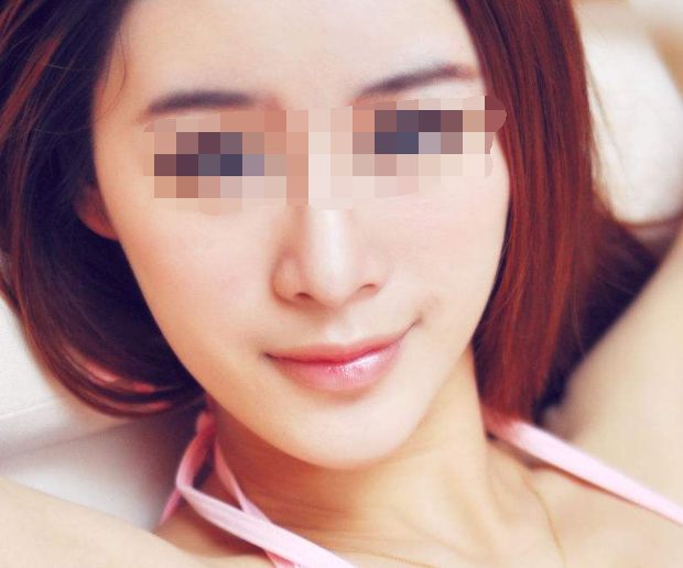 上海權(quán)威額頭紋去除醫(yī)院排行榜，免費(fèi)咨詢！