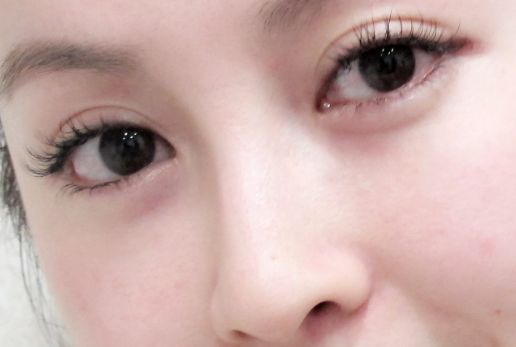 寧波超聲炮去動(dòng)態(tài)細(xì)紋，這些醫(yī)院等你來挑！