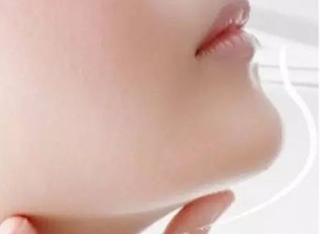 煙臺哪家整形醫(yī)院木偶紋修復(fù)效果好？排名前10醫(yī)療美容機(jī)構(gòu)匯總