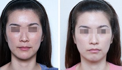 浙江十家專業(yè)治療黑痣的激光醫(yī)院排名及評測