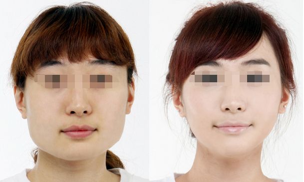 哈爾濱祛疤整形醫(yī)院實力排行榜，業(yè)界權威認證！