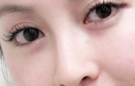 2024年鄭州光子嫩膚祛黑頭醫(yī)院口碑排行榜TOP10揭秘！