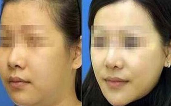 西安去動(dòng)態(tài)細(xì)紋整形醫(yī)院排行榜：十大精選醫(yī)美機(jī)構(gòu)推薦