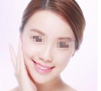 安徽眉弓提升手術(shù)排名：資深整形機(jī)構(gòu)實(shí)力大PK