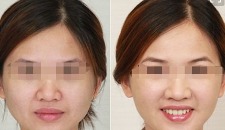 南寧十大值得信賴的黑眼圈整形醫(yī)院推薦