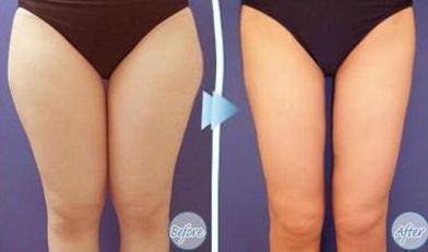 張家港胸部填充膠原蛋白美容醫(yī)院口碑榜單及排名細節(jié)