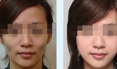 南京額頭紋激活細(xì)胞排名靠前的十大醫(yī)美機(jī)構(gòu)一覽