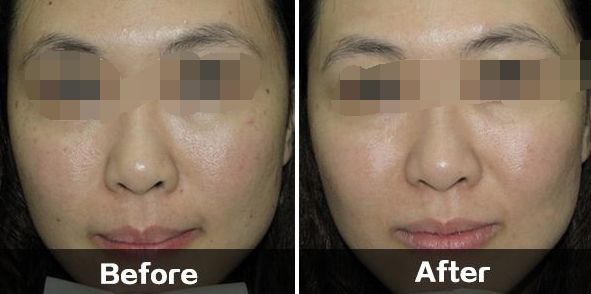 長沙針雕祛細(xì)紋整形醫(yī)院推薦：10家口碑卓著的選擇