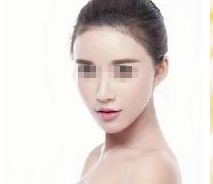 深圳哪家醫(yī)院做胸部整形效果好