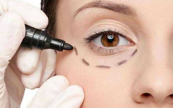 胸部整形失敗修復(fù)術(shù)，再無后顧之憂