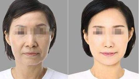 武漢太田痣治療最佳醫(yī)院排名TOP10大揭秘！