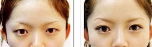 上海私密整形美容醫(yī)院排名前十揭曉！