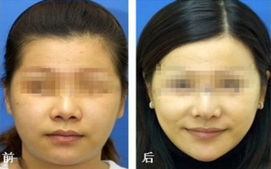 新疆優(yōu)質(zhì)陰道再造醫(yī)療美容醫(yī)院排名前10名單公布！