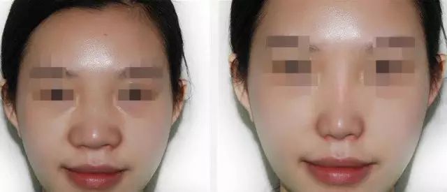 深圳水動力吸脂瘦腰整形醫(yī)院口碑推薦：權(quán)威專家榜單