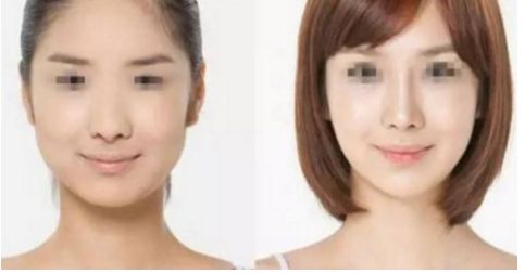 探尋蕭山哪家整形醫(yī)院針雕肥胖紋效果最佳？