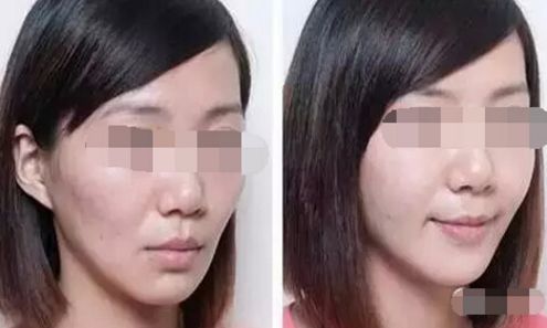 延吉口碑佳的無創(chuàng)美容整形醫(yī)院盤點(diǎn)