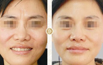 國(guó)內(nèi)十大優(yōu)質(zhì)胸型美化醫(yī)院排行榜，選擇放心專(zhuān)業(yè)醫(yī)療機(jī)構(gòu)，為你全面解析！