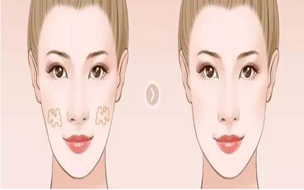 膠原蛋白注射解讀：如何激活膠原細(xì)胞，維持長(zhǎng)達(dá)20個(gè)月的新生狀態(tài)