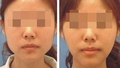 南京哪家醫(yī)院可以去胎記？