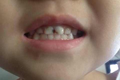 珠海疤痕修復手術實力強勁的10家整形醫(yī)院大盤點