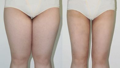 南京魚尾紋治療醫(yī)院排名榜：10家整形醫(yī)院技術(shù)解析