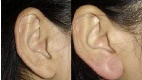 長(zhǎng)沙下巴整形醫(yī)院排名大揭秘！這些醫(yī)院實(shí)力超群，助你完成完美蛻變！