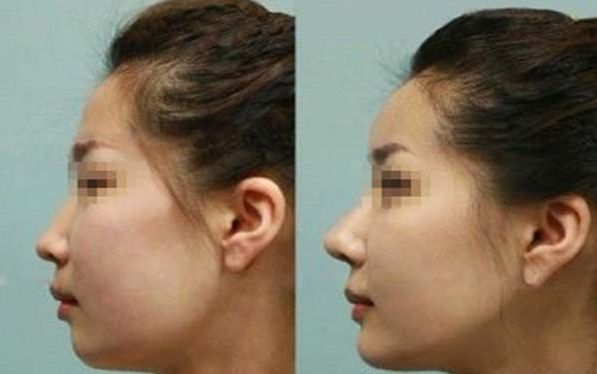 青島專業(yè)脈沖強光去紅血絲醫(yī)院排行榜TOP10