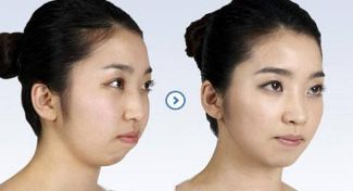 2024成都頸部皺紋提拉手術(shù)十佳醫(yī)療美容醫(yī)院榜單揭曉！