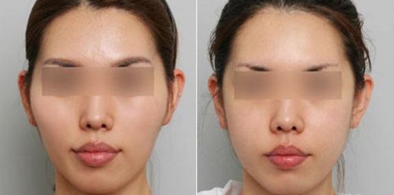 甘肅點陣激光去黑色素醫(yī)療整形醫(yī)院排名及評價TOP10揭曉！